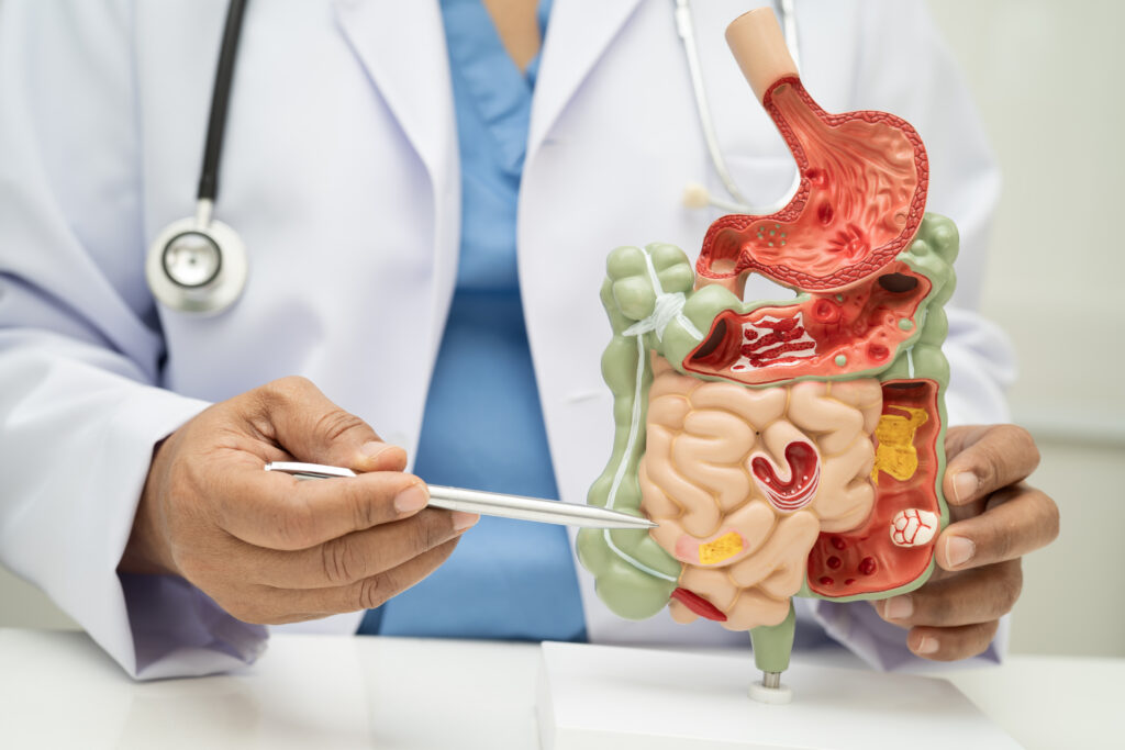 Doctor holding a model of the stomach and intestine digestive system