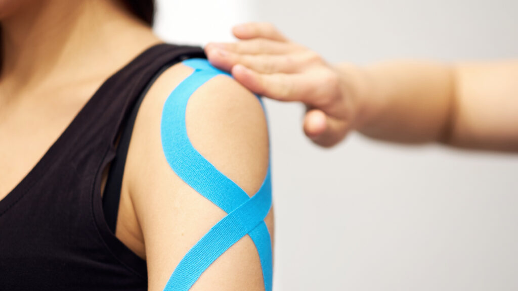Kinesiology tape applied to a female patients injured arm