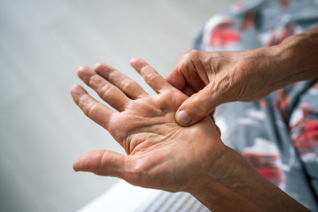 Close-up of a hand examining the palm for injury, hand and palm pain relief offered at Mast Health chiropractic clinic in Tampa, FL